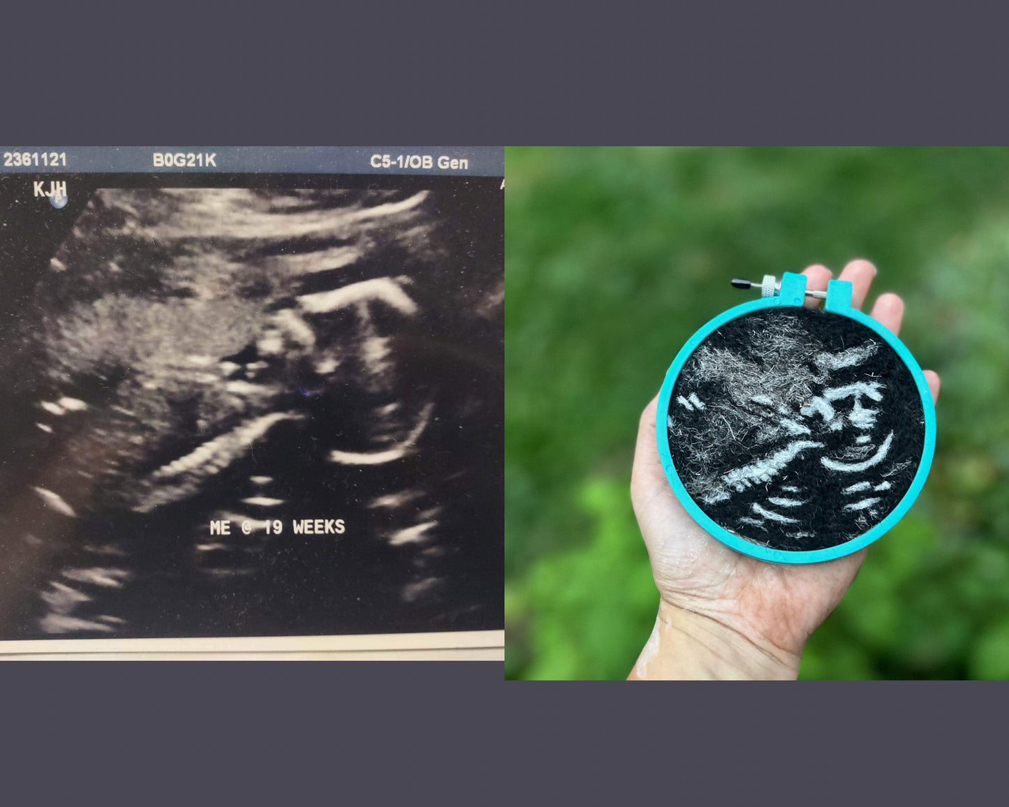 Custom Felted Sonograms