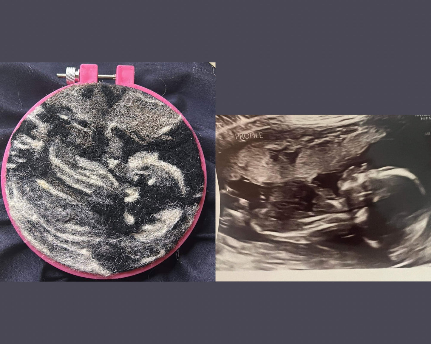 Custom Felted Sonograms